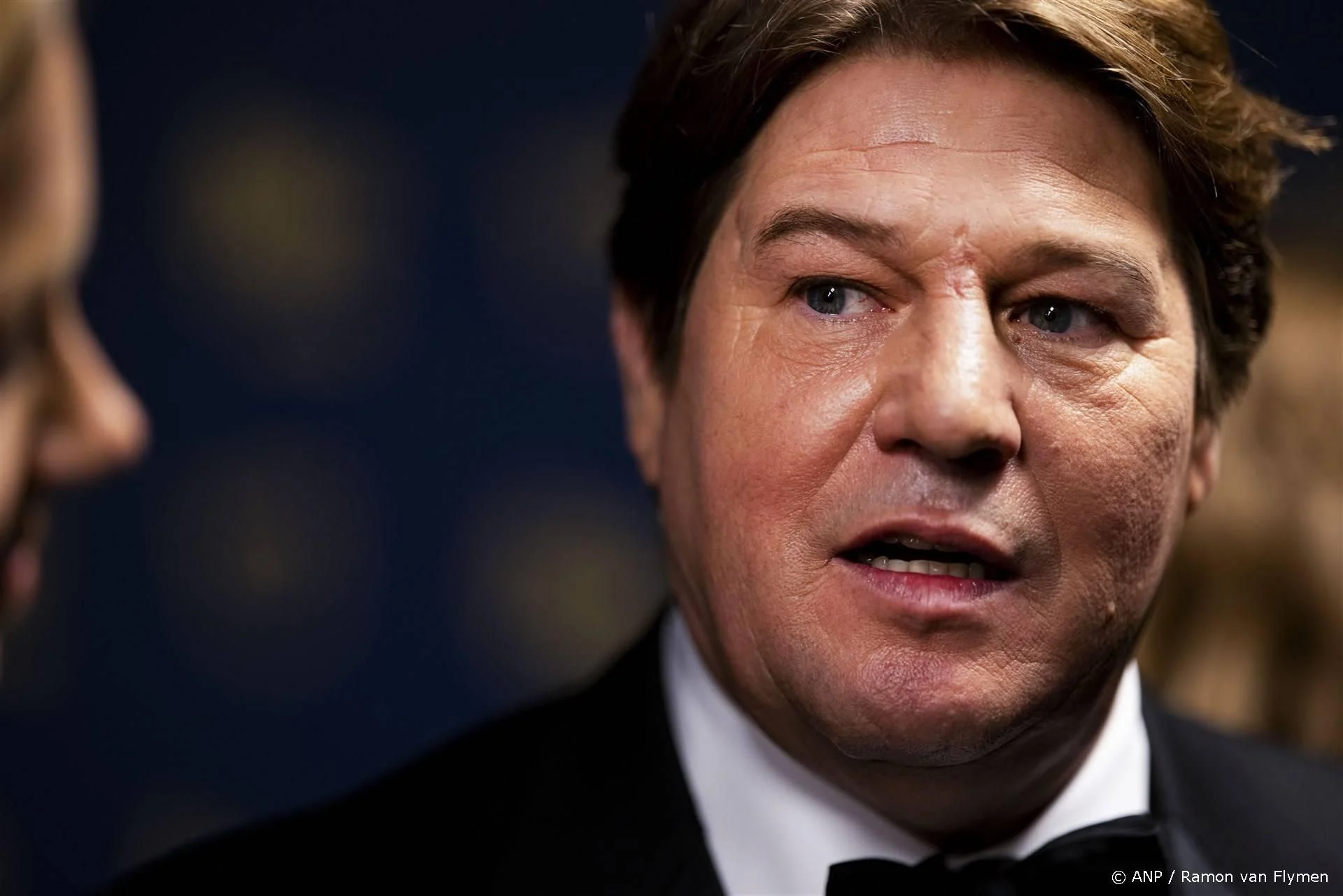 Hoe Gaat Het Nu met Martijn Krabbé? Status & Gezondheid 2026