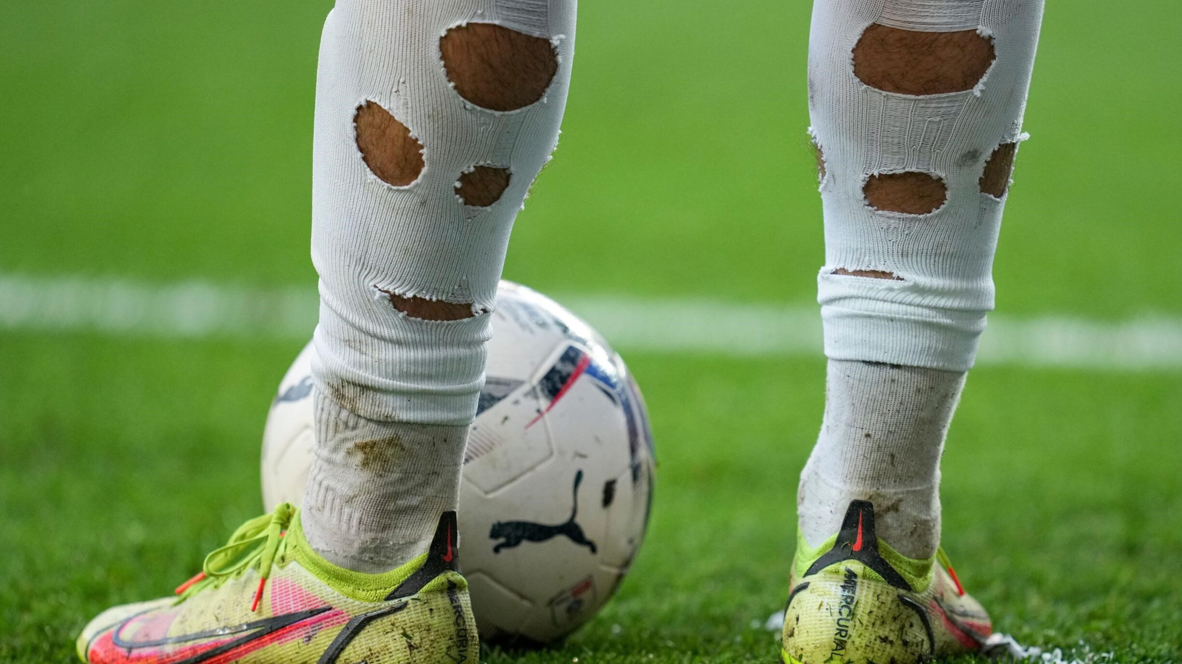 Waarom voetballers gaten in hun sokken dragen tijdens wedstrijden