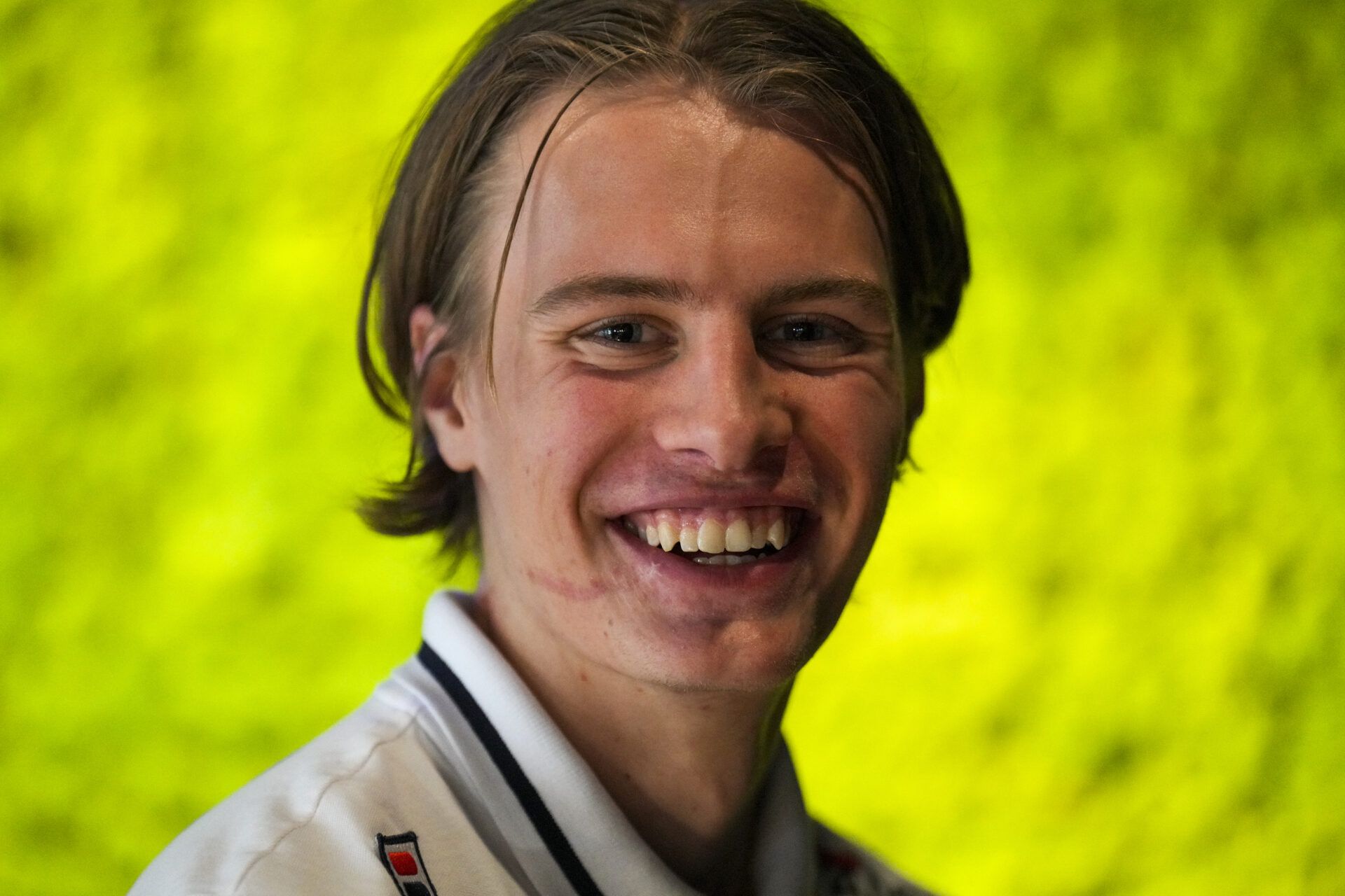 Hoe komt Jens van ’t Wout aan litteken en gouden tand
